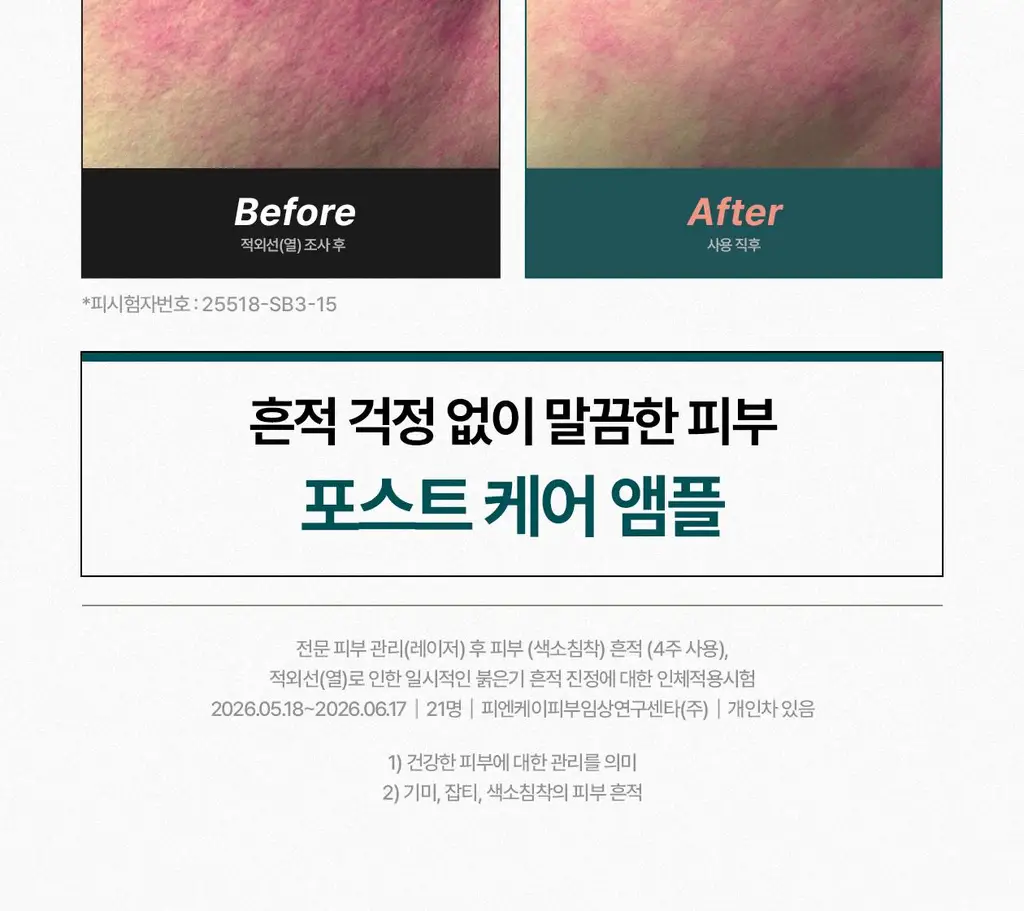 [흔적 리페어_c-PDRN 10,000 PPM]리쥬덱스 더마 리페어링 솔루션 앰플 10mLx2EA 상세페이지 10